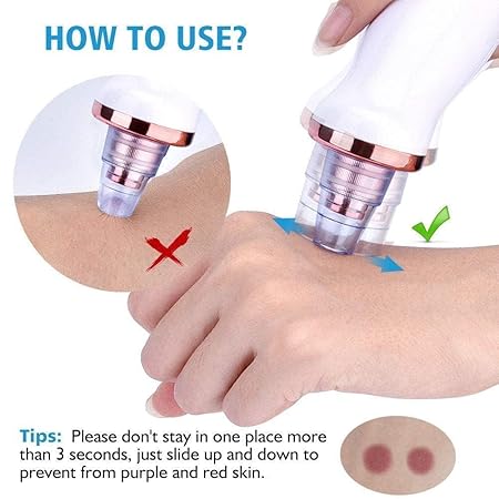 Black head remover