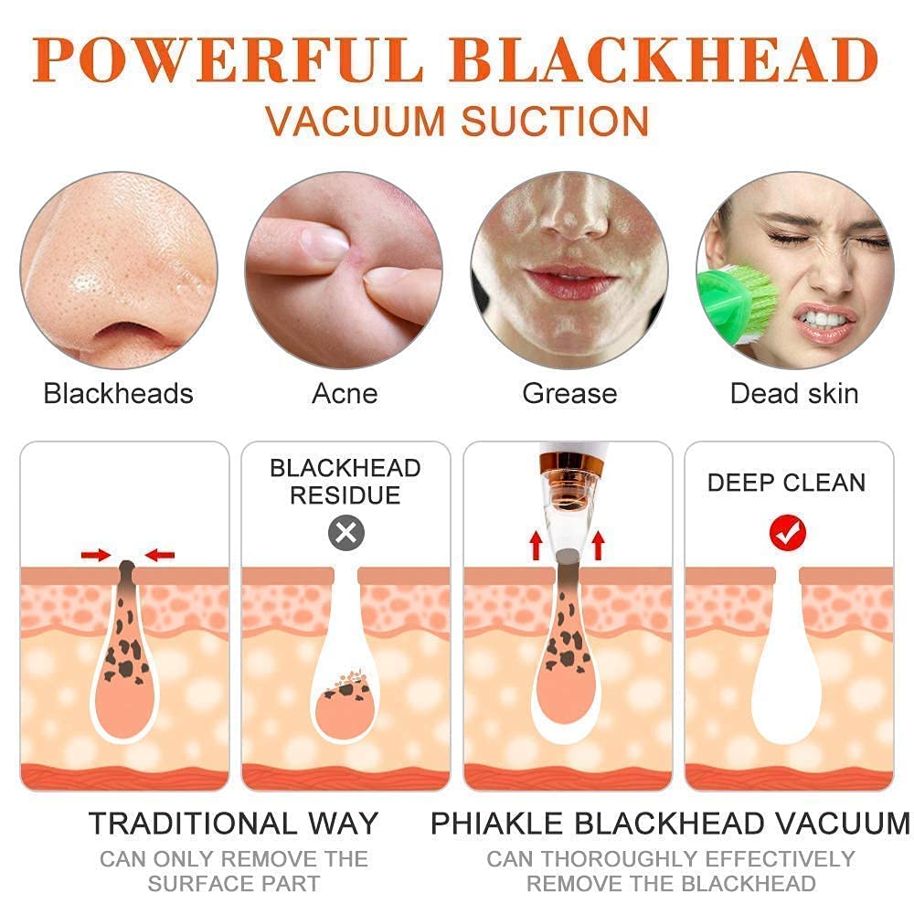 Black head remover